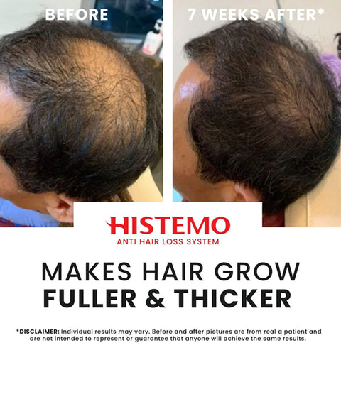 Histemo ION-TO G Hair Tonic